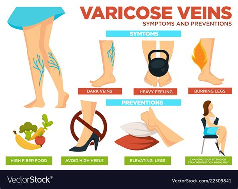 Synthesize More Than 28 Articles How To Avoid Varicose Veins Latest