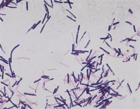 Características Microscópicas Bacilo Gram Positivo 05 X 3 6 µm