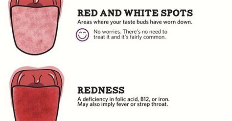 What Does Your Tongue Say About Your Health Infographic Dental