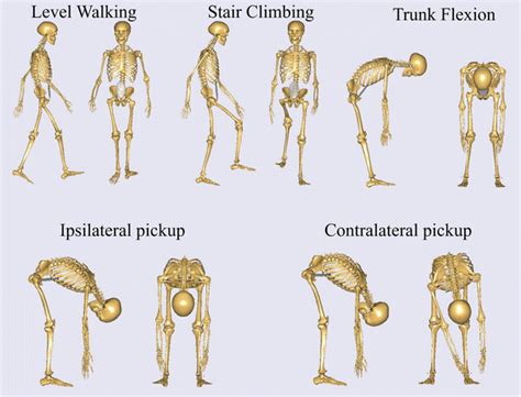 History and etymology for ipsilateral. Influences of lumbar disc herniation on the kinematics in ...