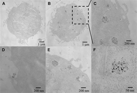 Tem Images Of Skbr 3 Cells Incubated With A Rod Shaped And B