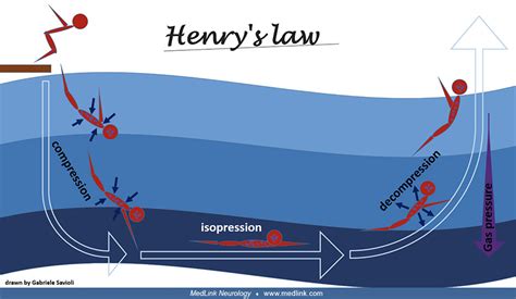 Decompression Sickness Medlink Neurology