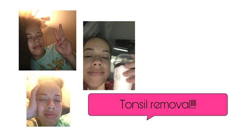 Soo I Got My Tonsils Removed YouTube