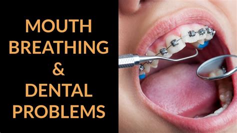 Mouth Breathing And Dental Problems Youtube