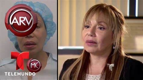 Mujer Casi Queda Desfigurada Tras Inyectarse La Cara Al Rojo Vivo