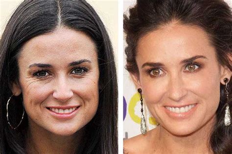 Did demi moore undergo any plastic surgery enhancements? Demi Moore Plastic Surgery: Boobs, Nose Job and Young