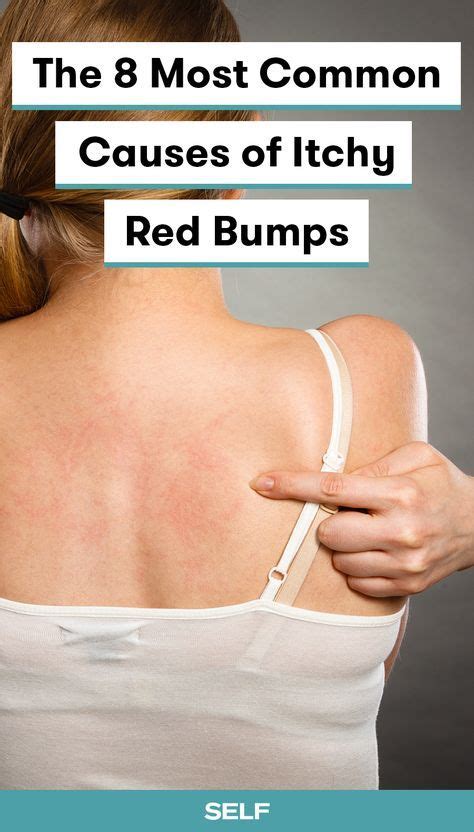 10 Common Causes Of Itchy Red Bumps And Skin Rashes Itchy Red Bumps