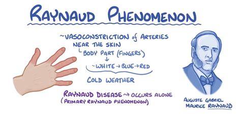 Raynaud Phenomenon Video Anatomy And Definition Osmosis