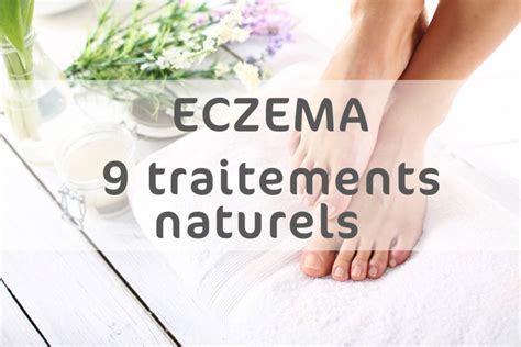 Top 9 Des Rèmedes Et Traitements Naturels Pour Soigner Leczema