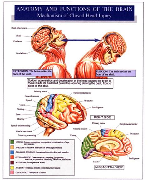 Closedheadinjury