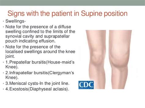 Anatomy And Examination Of The Knee