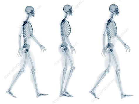 Skeleton Walking Artwork Stock Image F0082745 Science Photo Library