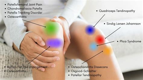 Diagnosing Knee Pain Chart