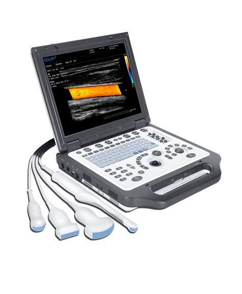 G30 All Digital Color Doppler Ultrasound Diagnostic System Shenzhen