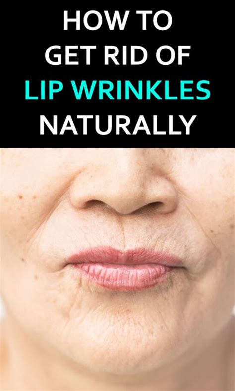 How To Get Rid Of Wrinkles Naturally Lip Wrinkles How To Line Lips