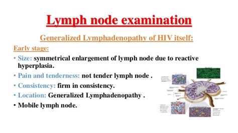Generalized Lymphadenopathy Related To Hiv