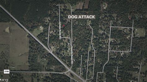 Family seeks support for woman after dog attack | 12newsnow.com