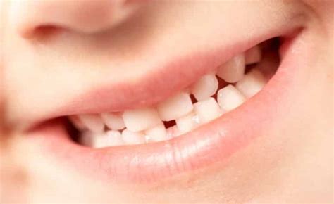 Kenali Prosesnya Nih 5 Tahap Pertumbuhan Gigi Bayi Axel Dental