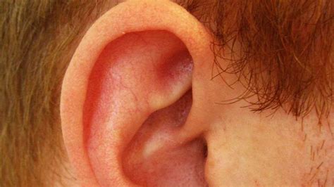 How To Tell If Ear Cartilage Is Infected Howcast