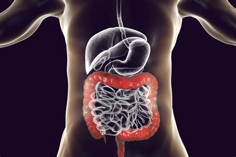 Only when the tumor reaches a large enough size there are symptoms of large intestine obstruction, and during the decay (necrosis) of a part of the tumor or. Colon (Large Intestine): Anatomy, Function, Structure