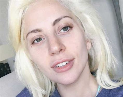 20 photos of lady gaga without makeupdo you ever imagine lady gaga without makeup? Lady Gaga Plastic Surgery: Boobs (Boob Job), Nose Job, Botox