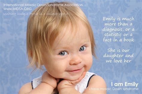 Mosaicism Down Syndrome