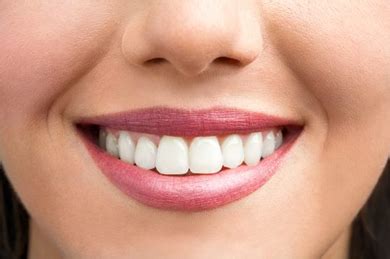 Apakah Gigi Sehat Selalu Berwarna Putih Itjen Kemendikbud