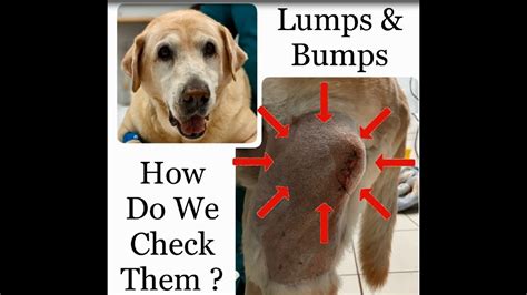 Lumps And Bumps Checkup Youtube