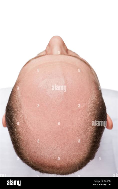 Bald Man Head Stock Photo Alamy