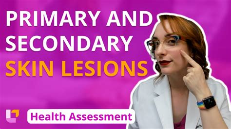 Primary And Secondary Lesions Health Assessment For Nursing Students