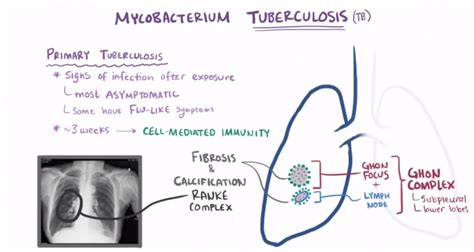 31 Pathogenesis And Clinicopathology Of Tuberculosis Greekdoctor