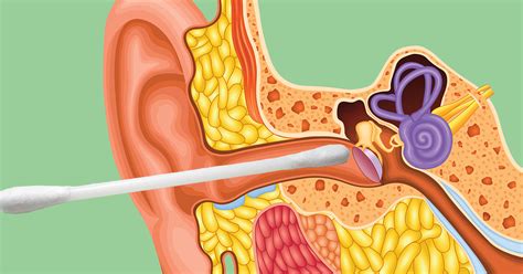 why you shouldn t use q tips to clean your ears attn