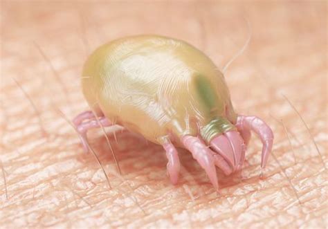 Dust Mite Bites Overview And More