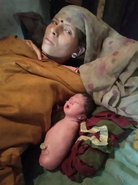 Baby Born Without Arms And Legs In India Leaves Doctors Puzzled Where