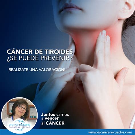 Lista 93 Imagen Cancer De Tiroides Sintomas Fotos El último