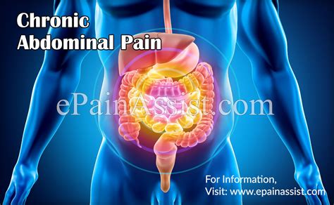 Gastrointestinal Causes Of Abdominal Pain Diagram
