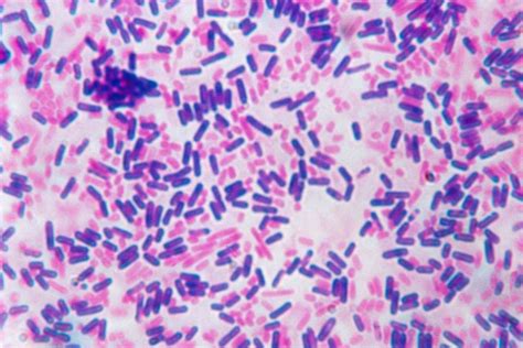Gram Negative Bacteria Under Microscope