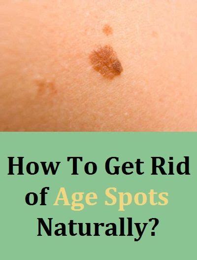 How To Get Rid Of Age Spots Naturally How To Get Rid Age Spots Hair Beauty