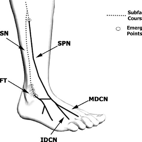 A And B Entrapment Of The Accessory Superficial Peroneal Sensory