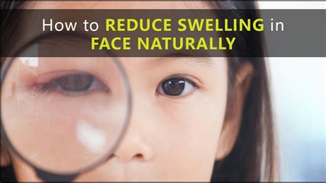 How To Reduce Swelling In Face Naturally At Home All Home Remedies