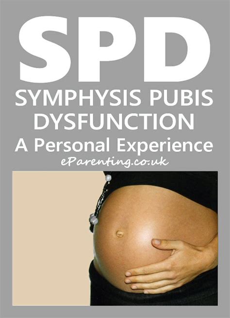 Spd Symphysis Pubis Dysfunction During Pregnancy