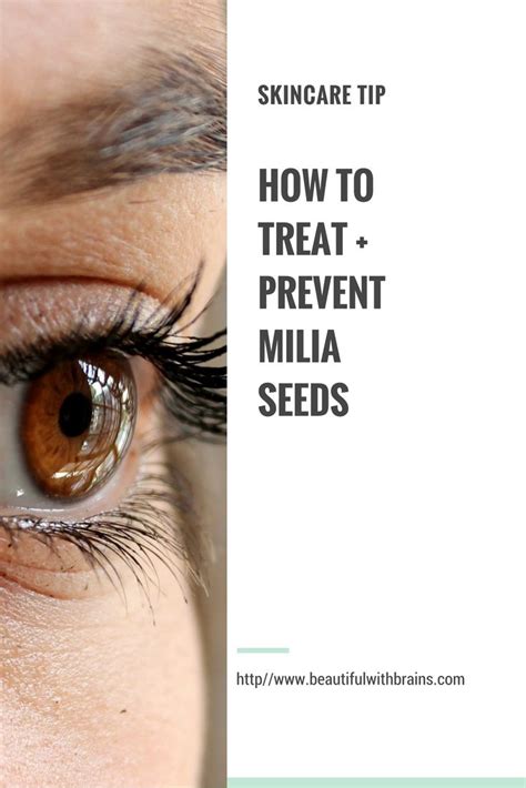 How To Prevent And Treat Milia Seeds Skin Bumps Skin Care Keratosis