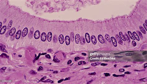 Simple Columnar Epithelium Pancreatic Duct 250x Shows Tall Columnar