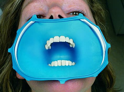 What Is A Rubber Dental Dam News Dentagama