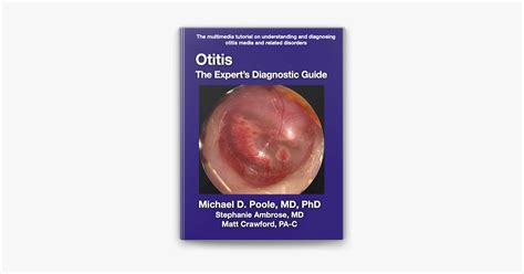 ‎otitis The Experts Diagnostic Guide On Apple Books