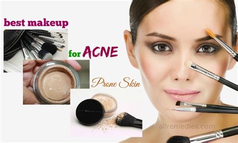 What Is The Best Makeup For Acne Prone Skin 17 Tips