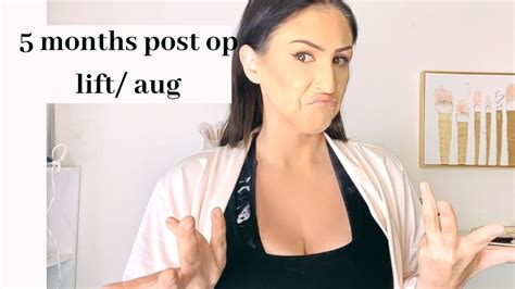 5 Month Breast Augmentation Post Op UPDATE YouTube