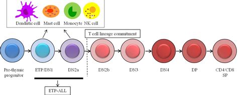 Early T Cell Precursor Acute Lymphoblastic Leukemia A Characteristic Neoplasm Presenting The