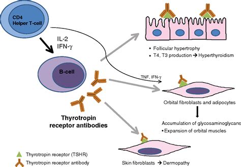 Pathogenesis Of Hyperthyroidism Semantic Scholar