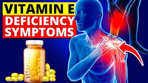 What Are The Symptoms Of Vitamin E Deficiency Youtube